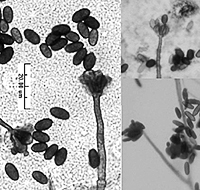 stachybotrys chartarum spores